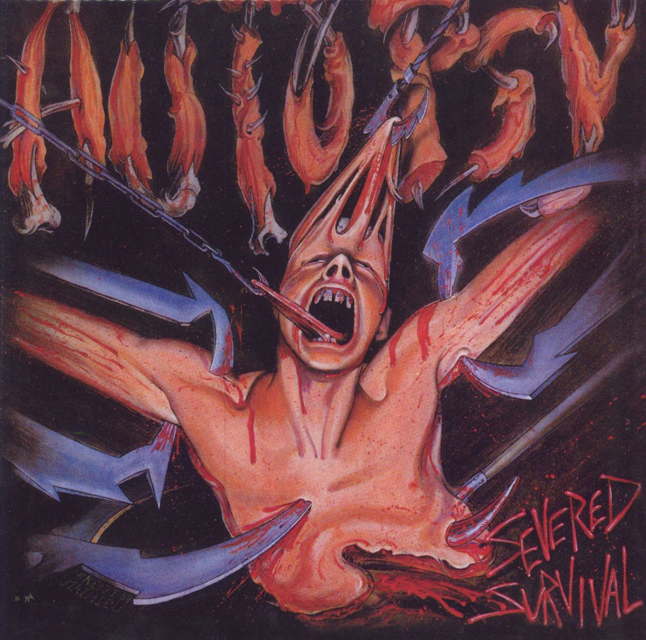 Autopsy